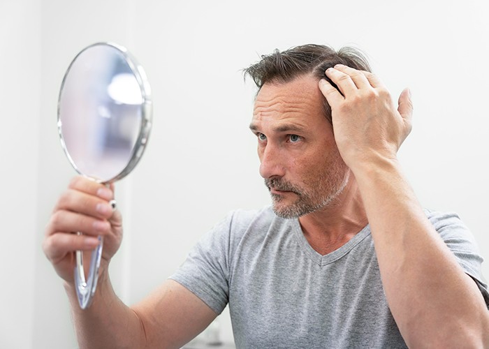 Hair Loss